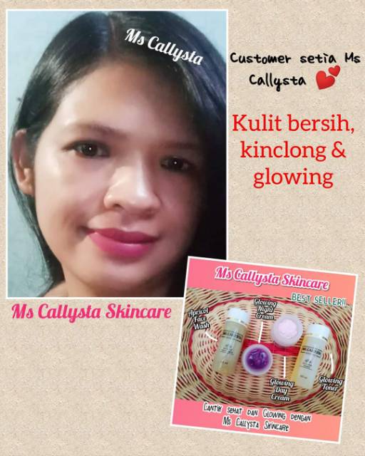Skincare Ms. Callysta 4x EXTRA  GLOWING WHITENING
