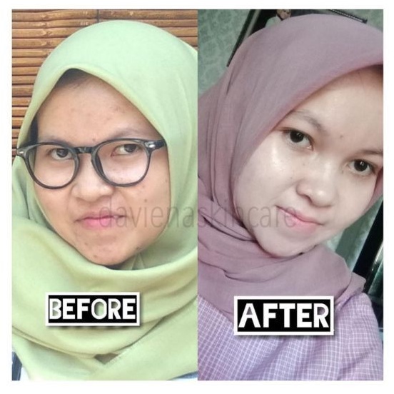 Daviena skincare medan - Glowing series Komplit / Paket Hemat Daviena Best seller-4