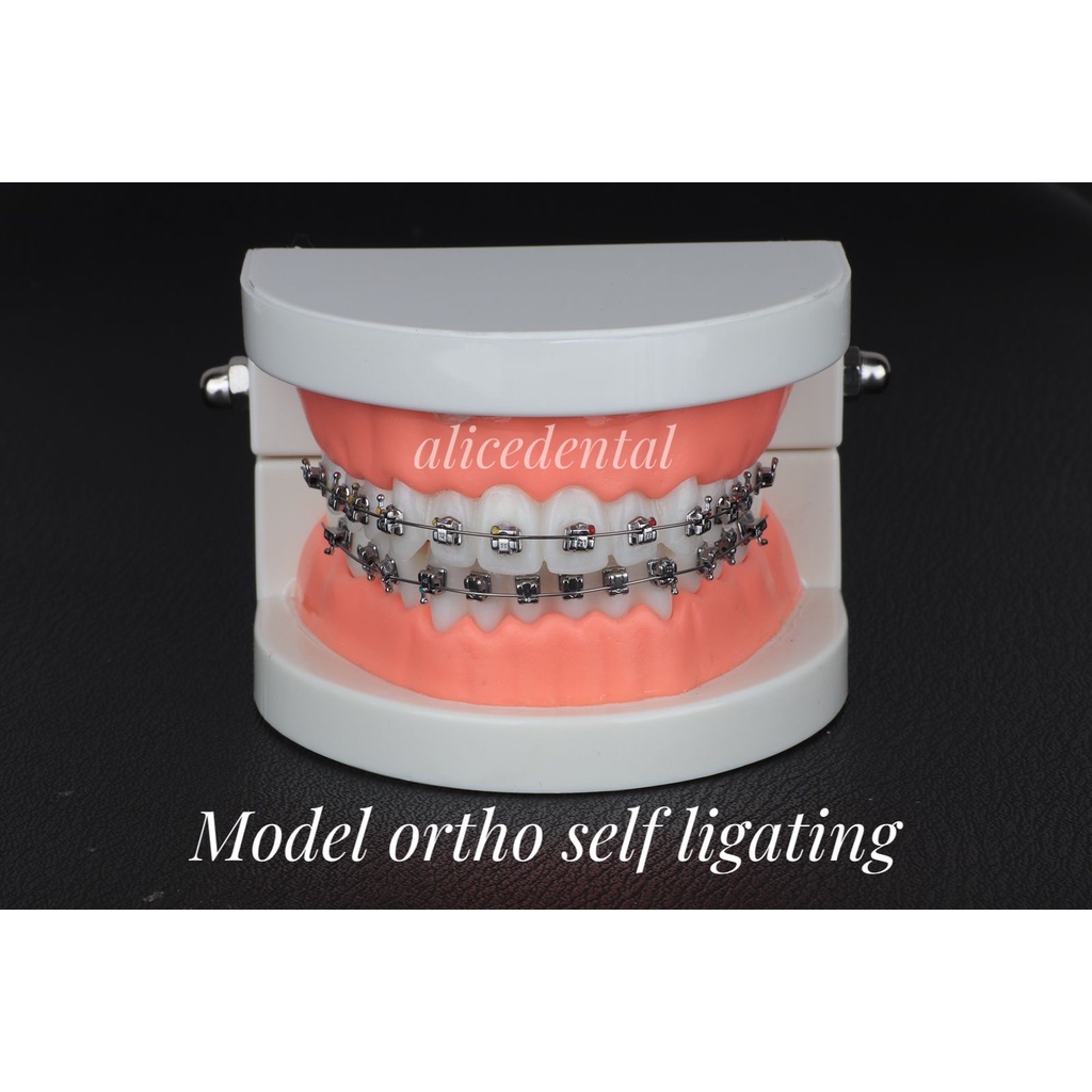 Model gigi ortho CERAMIC SAPHIRE SELF LIGATING sapphire dental study model orthodontic phantom studi
