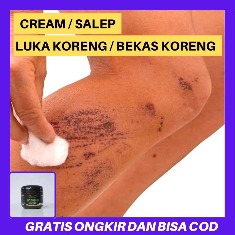 Cream Binahong Penghilang Bekas Koreng Paling Ampuh - Salep Penghilang Bekas Luka Di Kaki Ampuh - Sa