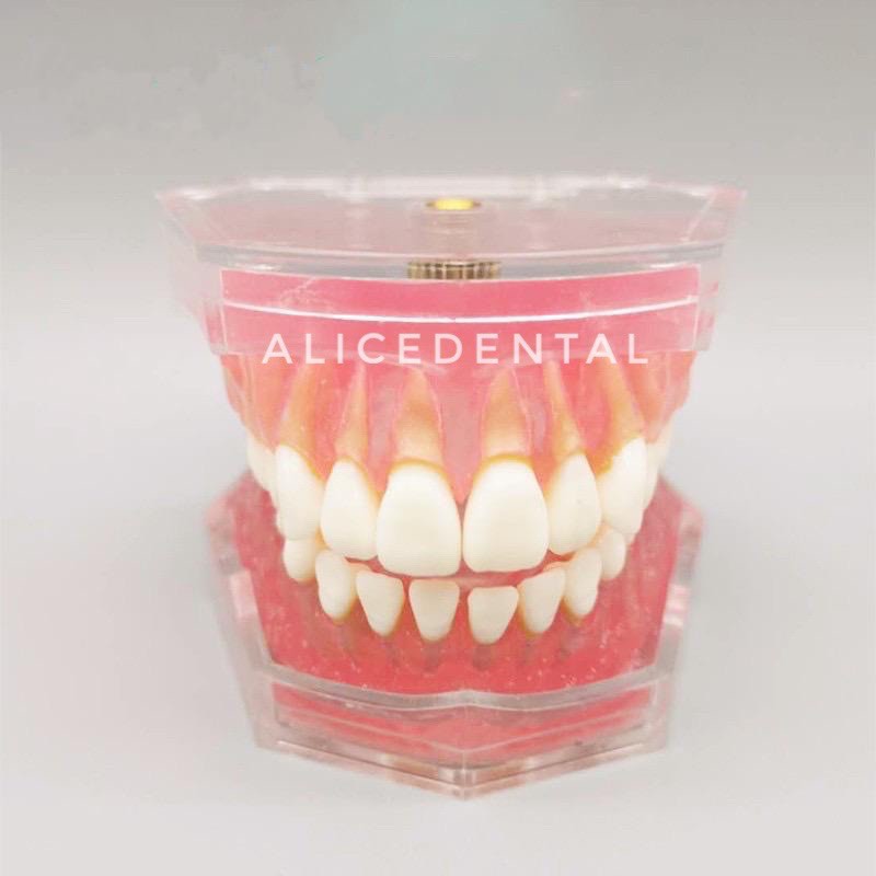 Dental study model typodont gigi bisa dilepas phantom studi edukasi gusi karet soft rubber gingiva