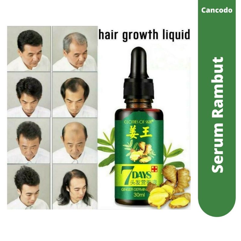 PENUMBUH RAMBUT BOTAK / ANTI RONTOK 7 DAYS King of Ginger 30ml