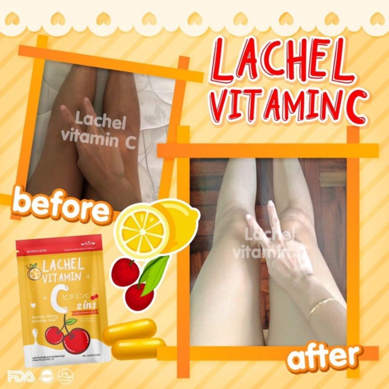 LACHEL VIT C / LACHEL VITAMIN C 100% ORIGINAL THAILAND