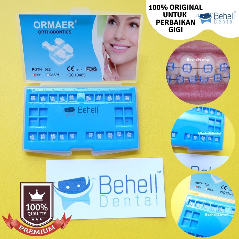 Paket behel gigi permanen bracket ceramic mini cute . Transfaran . Keramik . Bening . Transfaran Ori