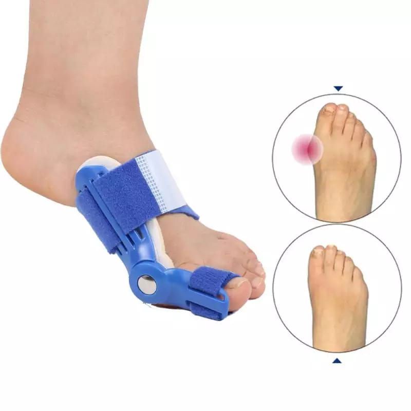 BUNION CORRECTOR SPLINT ALAT TERAPI KAKI BUNION HALLUX VALGUS TERAPI JARI KAKI BENGKOK INSOLE SEPATU