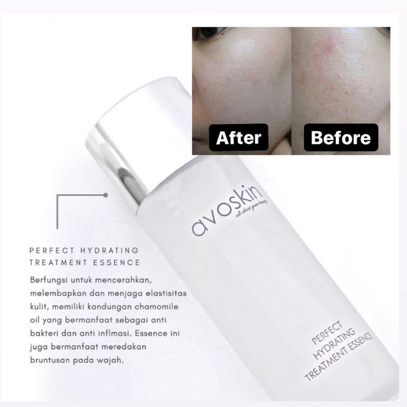 (GOSEND/COD) AVOSKIN PHTE PERFECT HYDRATING TREATMENT ESSENCE SPECIAL EDITION | LILAC ANNIVERSARY EDITION