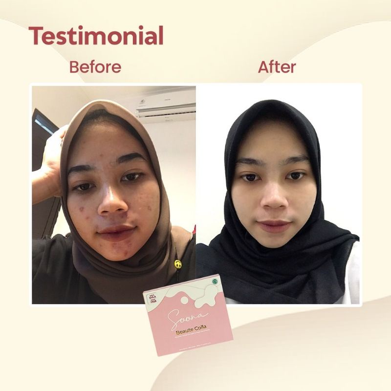 

Soona Minuman /Collagen Pelangsing Percantik Kulit Anggur / Buah Sayuran 15 Sachet