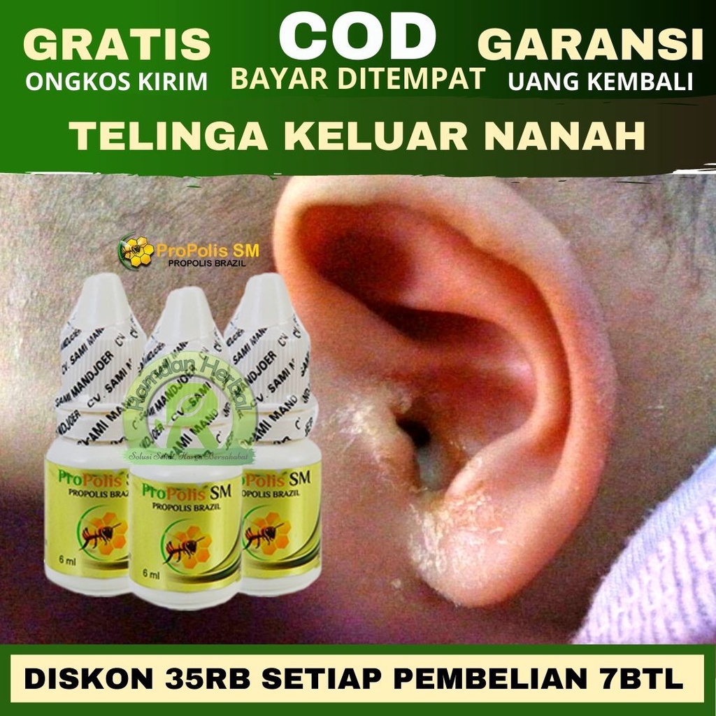 Obat Penyakit Telinga Keluar Nanah Telinga Keluar Cairan Bau Congek Telinga Bernanah Propolis SM