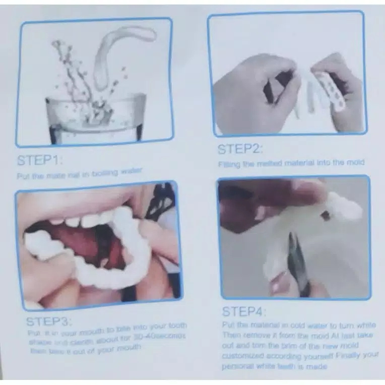 GIGI PALSU ATAS BAWAH GIGI PALSU LEPAS PASANG VENEER snap on smile