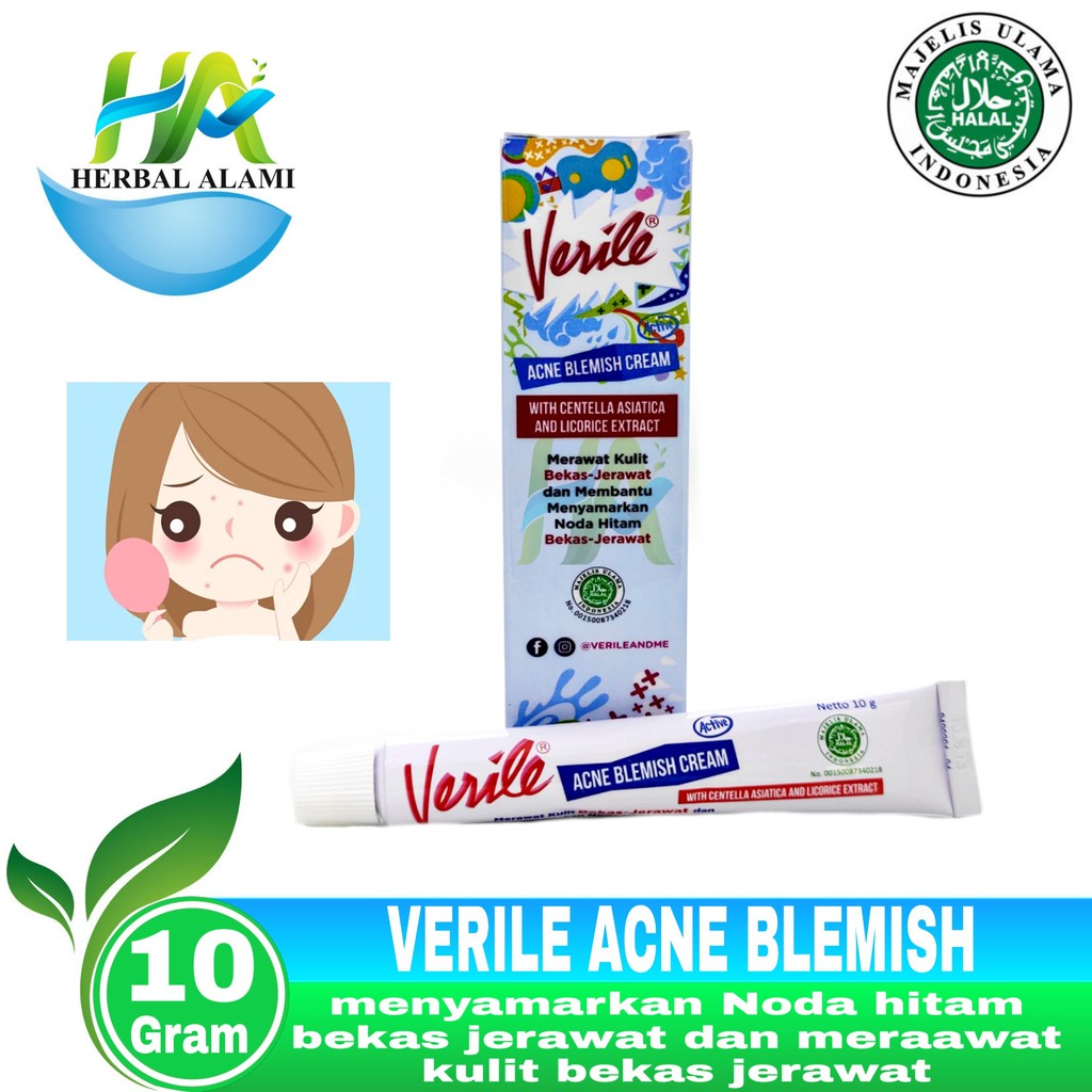 Verile Acne Blemish Cream - Obat Cream Bekas jerawat,Menyamarkan noda Hitam/Flek