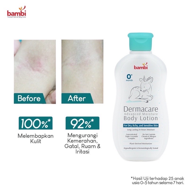 Bambi Lotion Bayi Sensitif Bambi Baby Dermacare Advanced Moisture Body Lotion