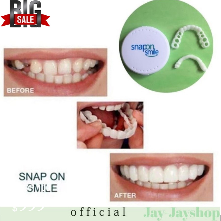 Perfect smile snap on smile / gigi palsu snap on instan ATAS &amp; BAWAH DALAM BOX TERLARIS!