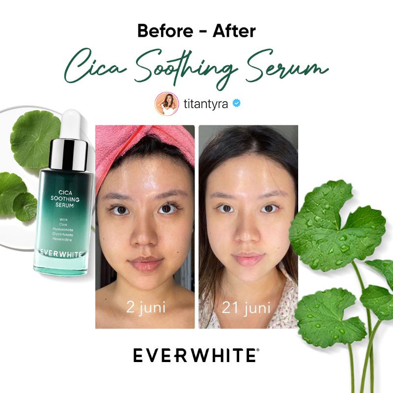 C Everwhite Cica Soothing Serum (Untuk Jerawat yang bandel)