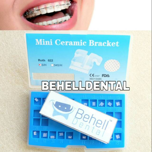 Paket behel gigi permanen bracket ceramic mini cute . Transfaran . Keramik . Bening . Transfaran Ori