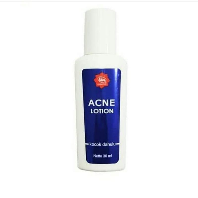 [Original] Viva Acne Lotion Ekfektif Menghilangkan Jerawat Obat Jerawat 30 ml