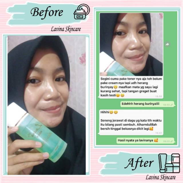 cream lavina skincare bpom