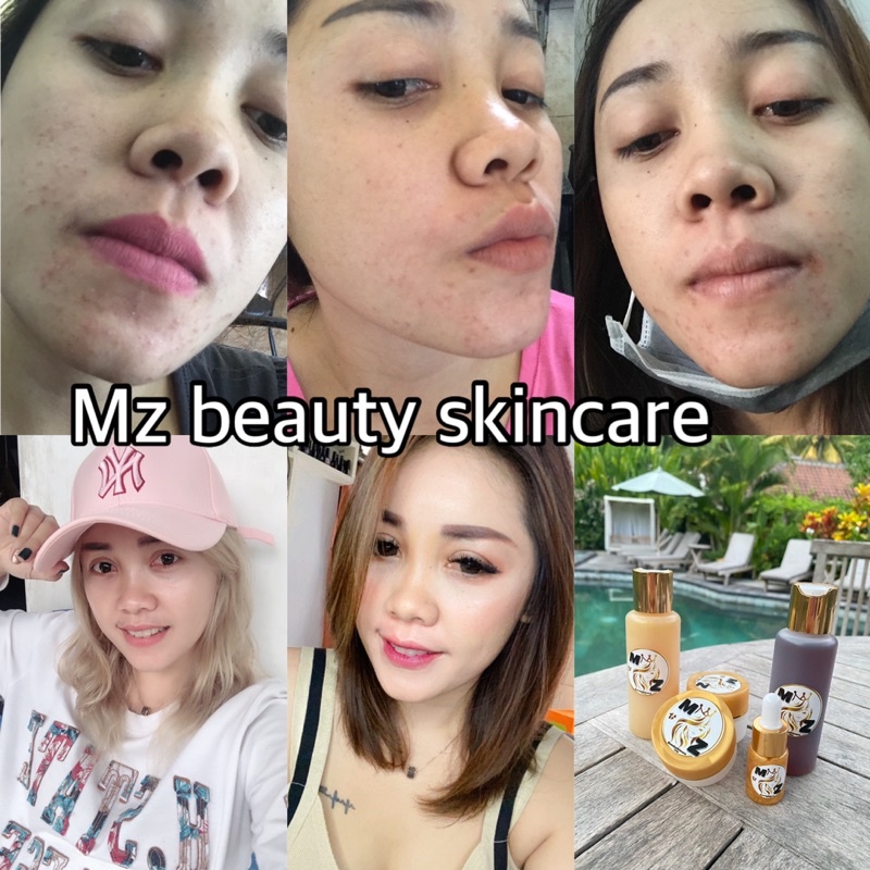 pemutih wajah ampuh dan aman MZ beauty skincare