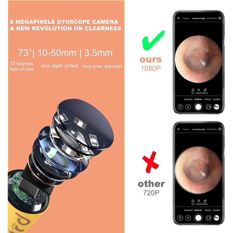 Bebird D3 Pro Pembersih Telinga Anak Smart Camera Korek Kuping