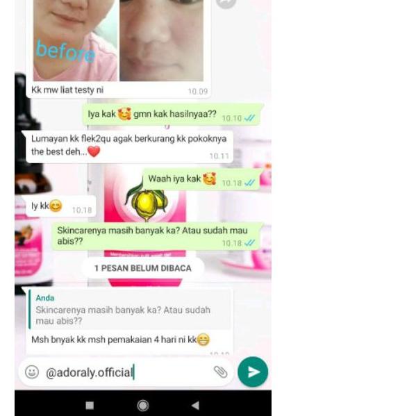 ✫ Adoraly skincare Original skincare paling glow adoraly skincare jakarta adoraly jakarta asli adora