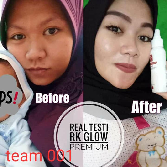 PAKET RK GLOW PREMIUM / CREAM RK GLOW ACNE / CREAM RK GLOW PREMIUM BPOM ORIGINAL 100%