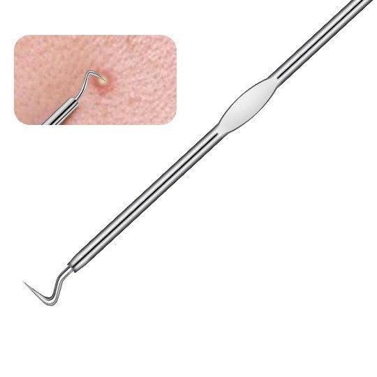 Komedo, jerawat dan set jarum komedo Set jerawat stainless steel    Acne removal needle set