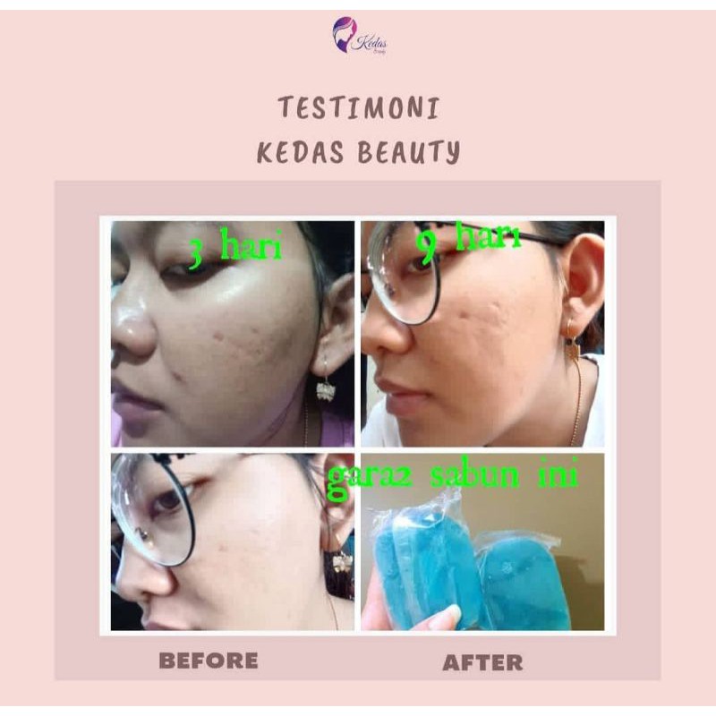 

kedasbeauty