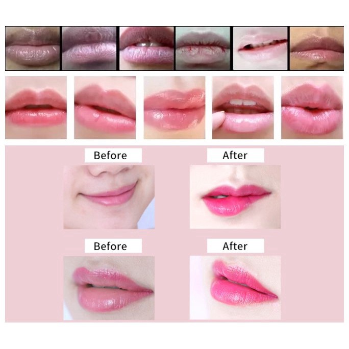 Legend Age Masker Bibir 3 in 1 Model Cherry untuk Kesehatan