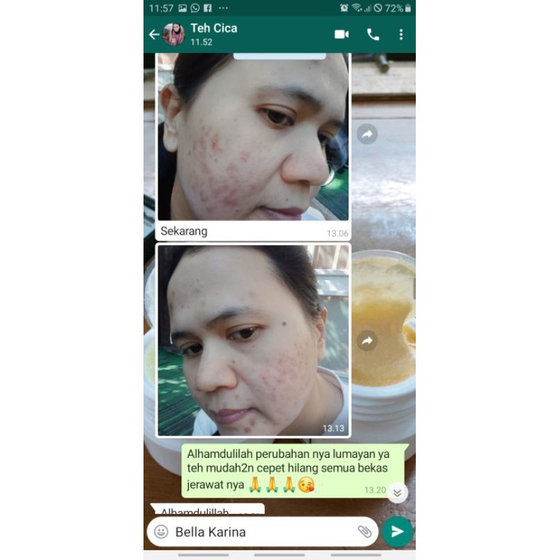 SERUM BOPENG ORIGINAL