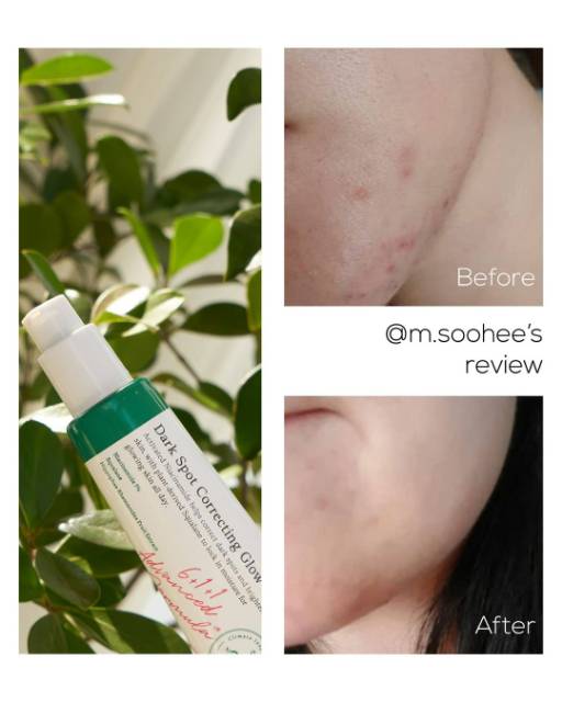 dark spot correcting glow serum watson