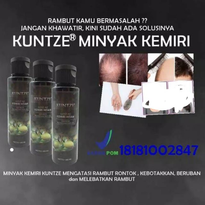 ☀️ YAMSHOP88 ☀️ Minyak Kemiri Kuntze / Penumbuh Penebal Penghitam Rambut Kunze Termurah Makassar