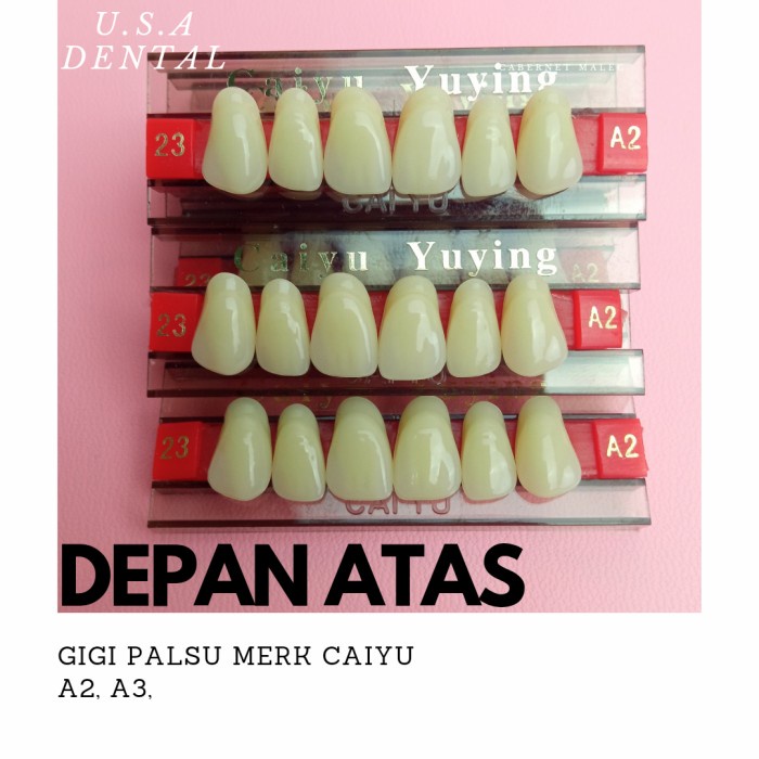 behel- dental gigi palsu caiyu depan atas 1 papan - a2 -behel.