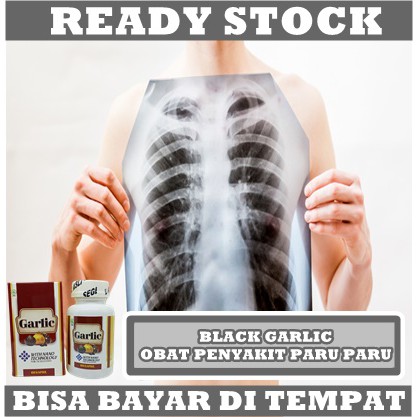 Obat TBC Paru - Obat Paru Paru Sesak Nafas - Obat Batuk Berdarah Kering Berdahak - Obat Flek Paru Paru - Obat Paru Paru Basah, Cairan Di Paru Paru, Obat Bronkitis, Paru-Paru Kronis, Batuk Menahun, Obat Tuberculosis, Walatra Black Garlic 100 Kapsul BPOM