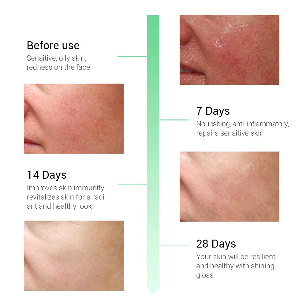 [BPOM] BREYLEE Soothing Serum Ekstrak Serum Sensitif untuk Menghilangkan Jerawat / Bekas Luka 17ml