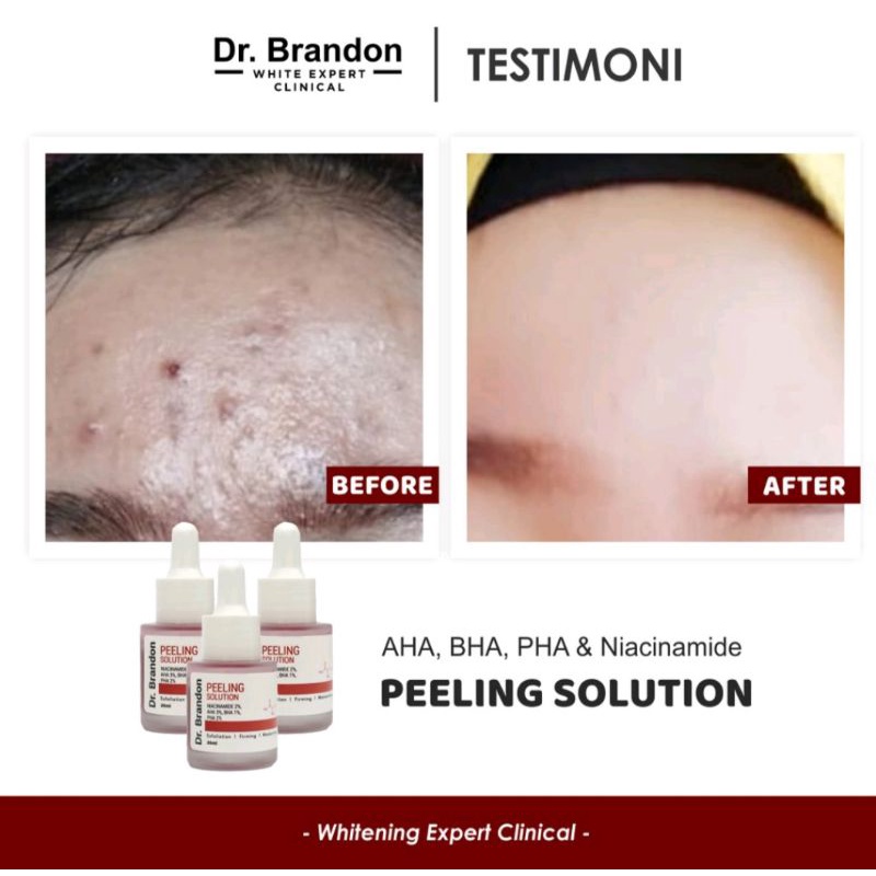 Dr.Brandon Revitalizing/Peeling Solution Face Serum 20ml