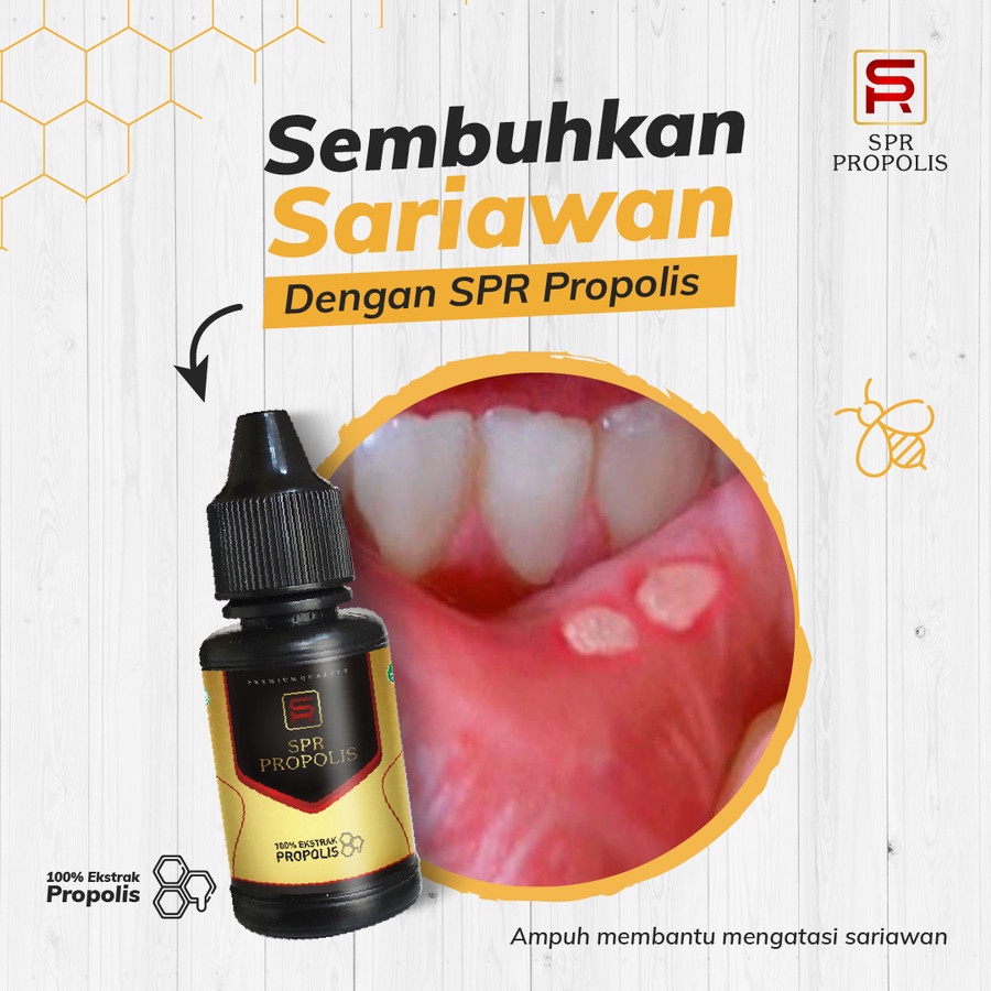 SPR Propolis Obat Sariawan Anak Dewasa Alami Ampuh Herbal BPOM
