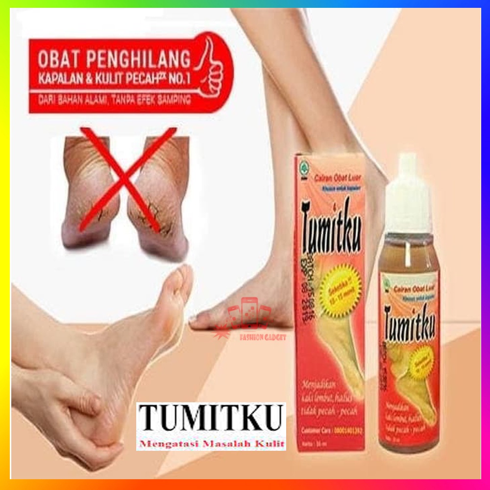 Tumitku 30ml Mengatasi Kaki Pecah &amp; Kapalan obat kaki kapalan Pecah Pecah