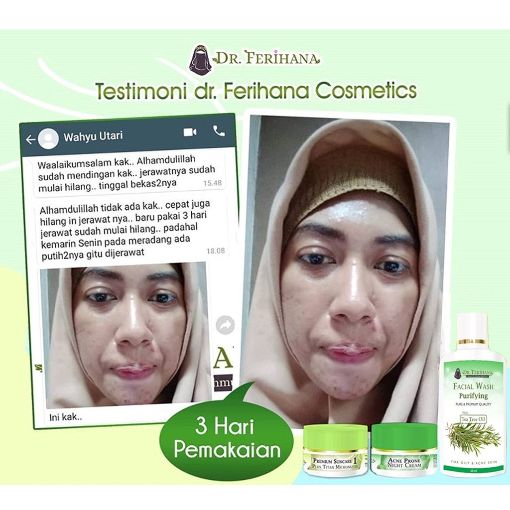 PAKET UNTUK MENGATASI JERAWAT RINGAN FACIALWASH KECIL