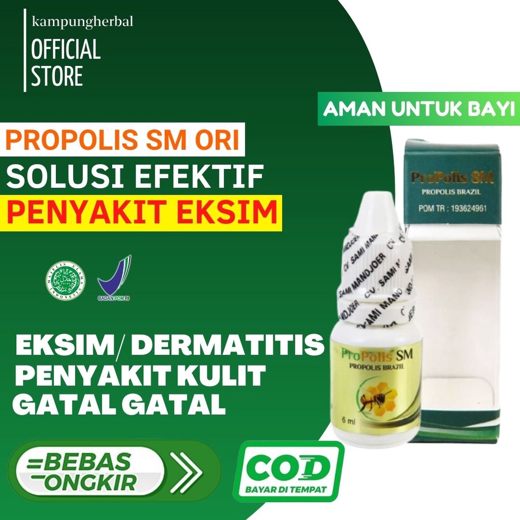 Obat Eksim Untuk Bayi Ruam Kulit Bayi Ruam Popok Kulit Kemerahan Iritasi Kulit Bayi Dermatitis Atopi