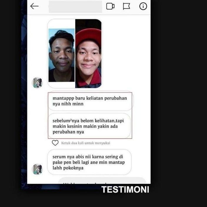 ⅎ ( Bisa ) ELVICTO BRIGHTENING SERUM WAJAH SKINCARE KHUSUS PRIA ASLI ☚