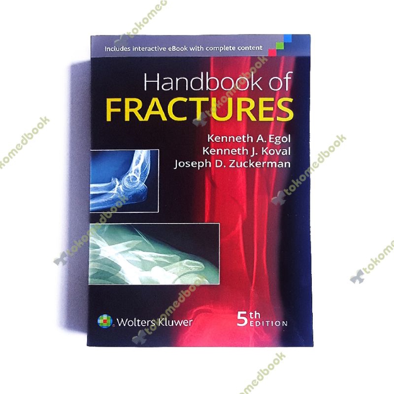 Buku Kedokteran Ortopedi Handbook of Fractures