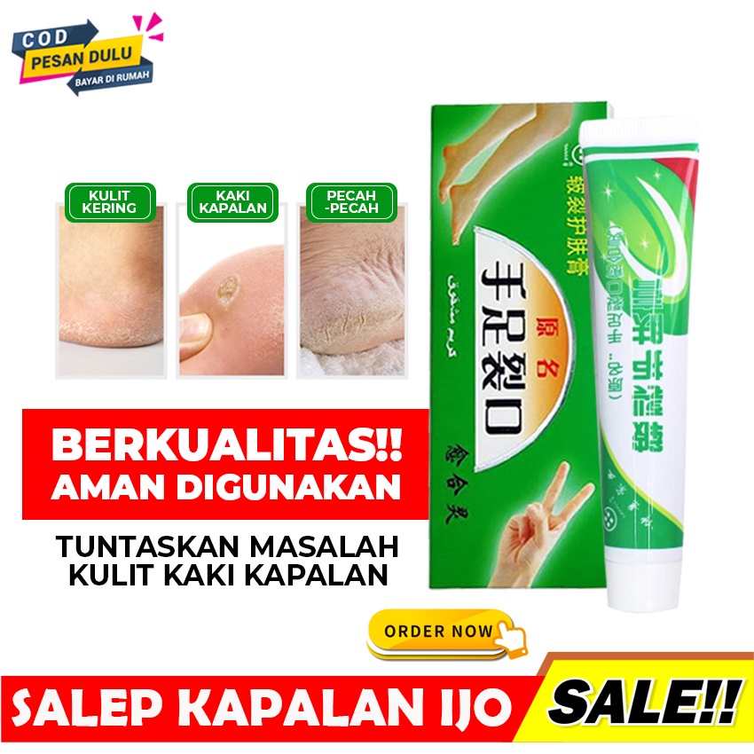 SHINE STAR - [ BISA COD ] SALEP KRIM HERBAL ATASI TUMIT KAKI TANGAN KERING EKSIM PECAH PECAH DAN KAPALAN