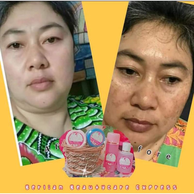 CREAM FLEK BERLIAN BEAUTYCARE EXPRESS