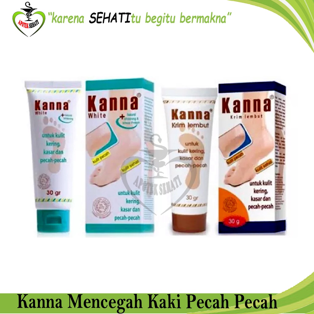 KANNA Soft Cream dan White Cream untuk Pelembab Kaki Pecah-Pecah Kanna Krim Kaki