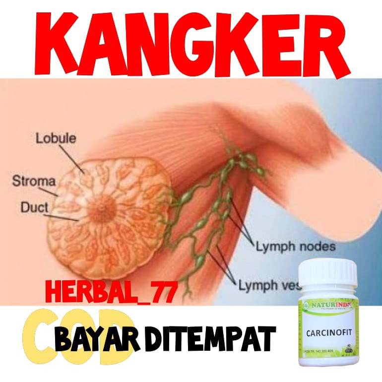 OBAT KANKER SERVIK KANGKER KANDUNGAN MIOM KISTA KANKER DARAH KANGKER KULIT KANGKER PAYUDARA HERBAL