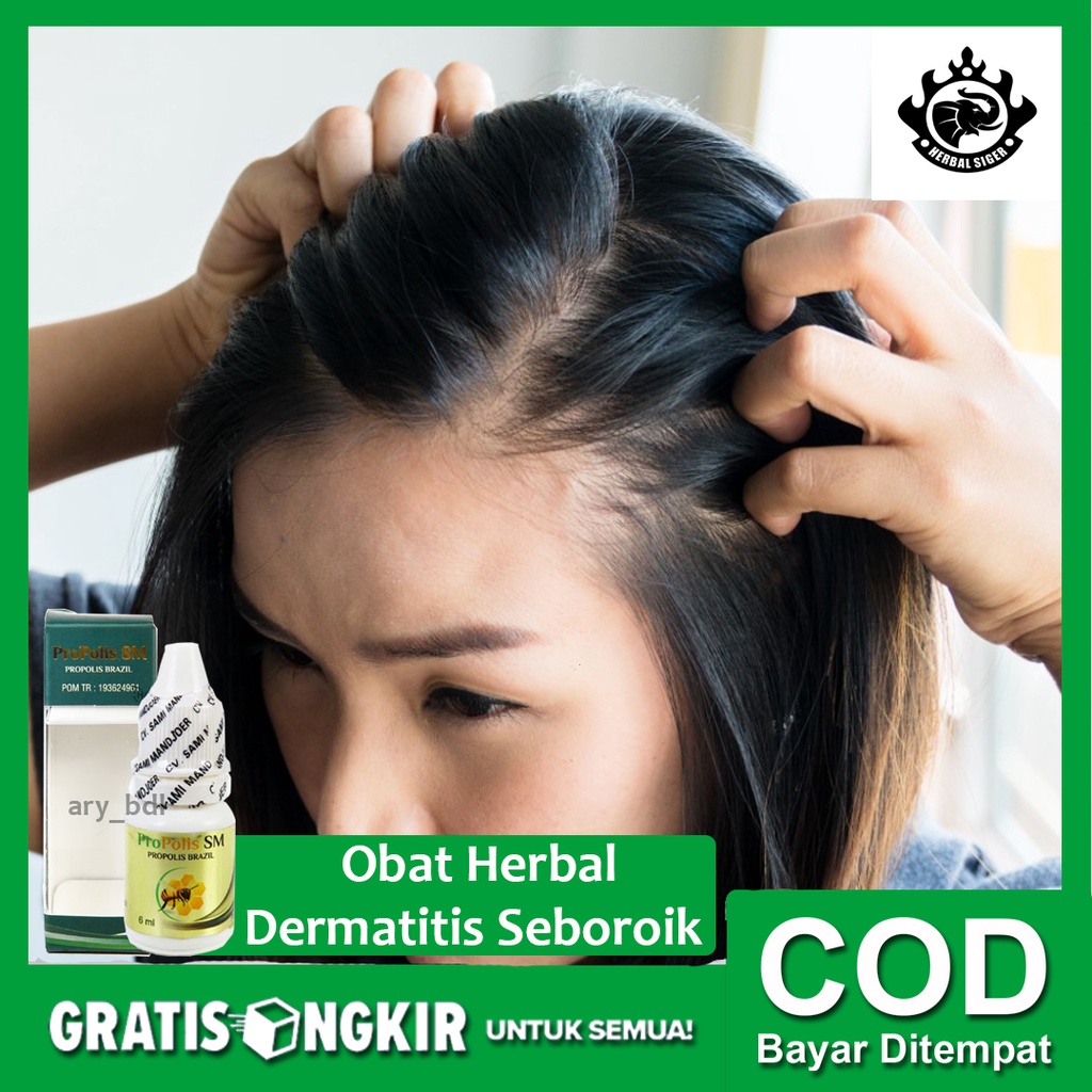 Jual Obat Herbal Dermatitis Seboroik Kulit Kepala Bersisik Berkerak Berwarna Kemerahan Dan 