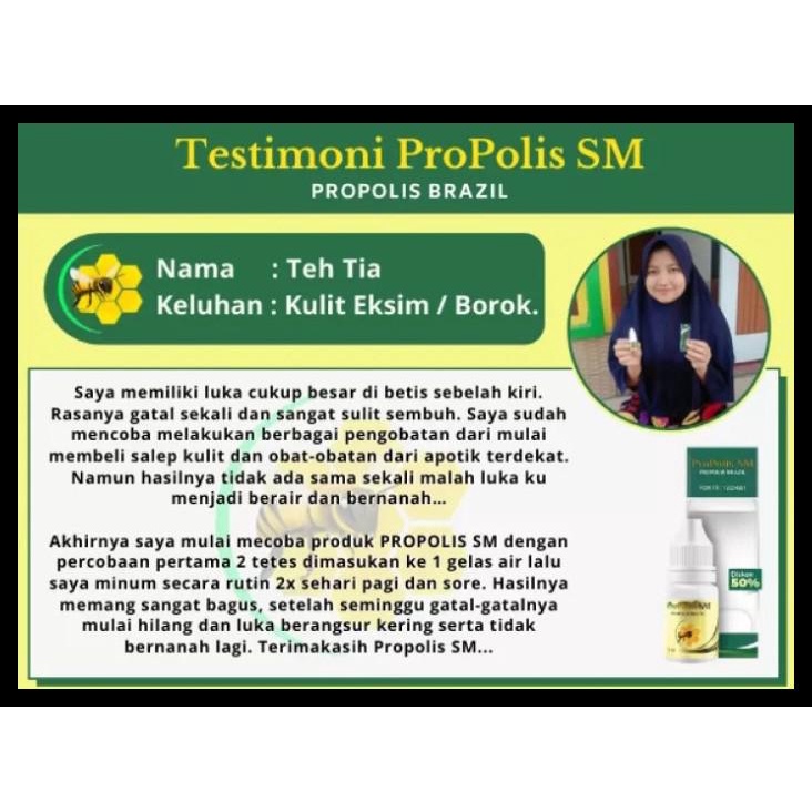 Obat Salep Kulit Jari Kering, Pecah Pecah, Bersisik, Mengelupas, Gatal