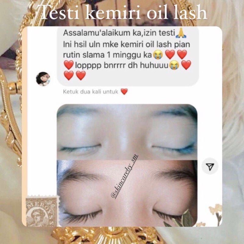 [ READY STOCK ] KEMIRI OIL LASH | SERUM PELEBAT ALIS DAN BULU MATA | MINYAK KEMIRI ASLI