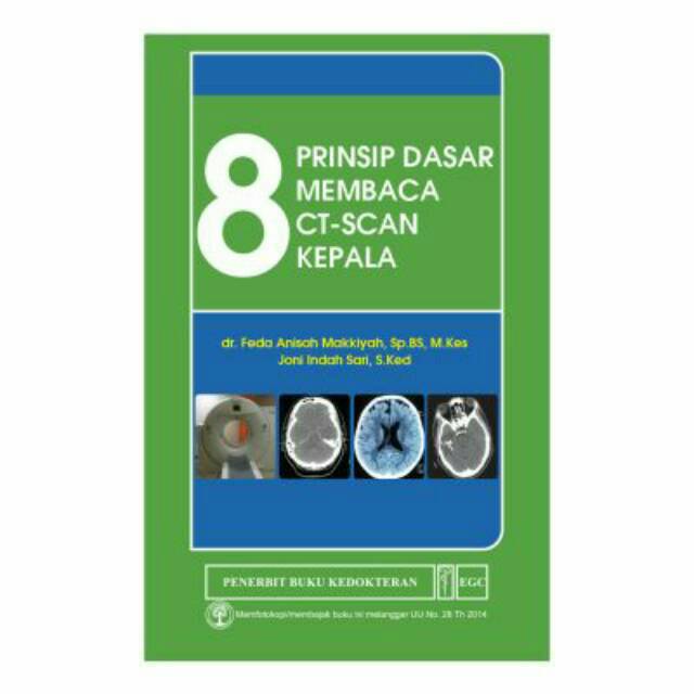 8 Prinsip Dasar Membaca CT-SCAN Kepala