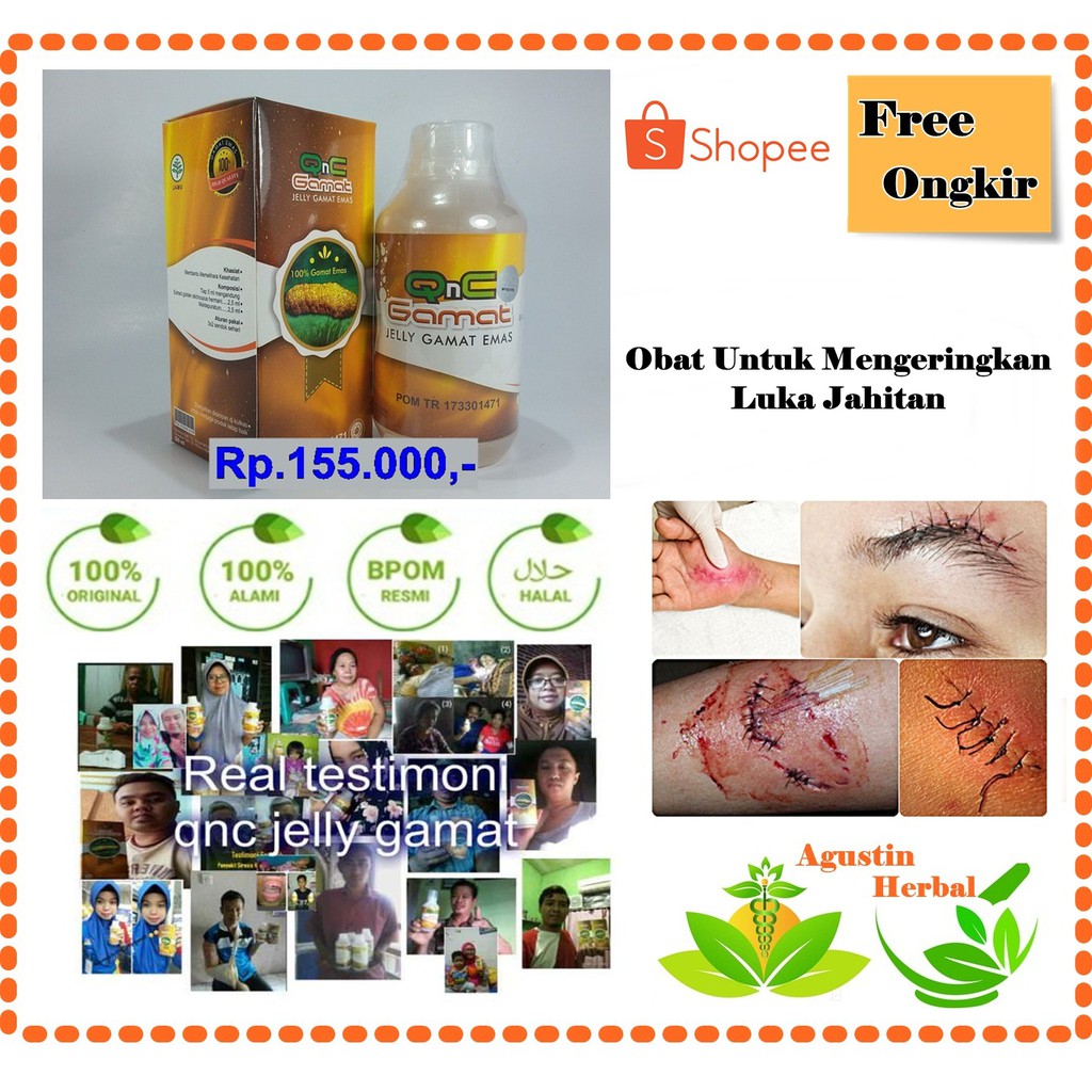 Cara Cepat Mengeringkan Luka Jahitan-Obat Luka Jahitan