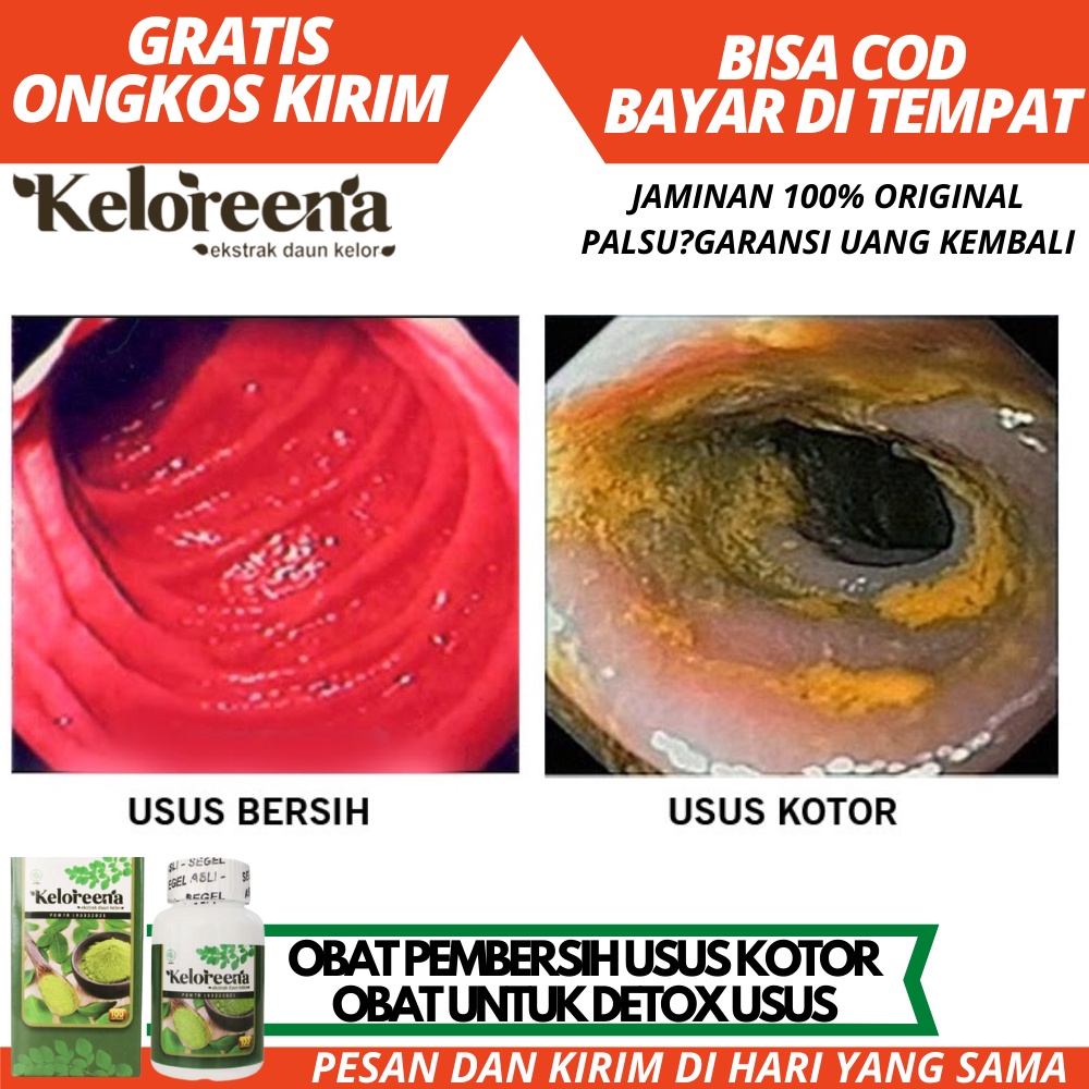 Obat Herbal Pembersih Usus Kotor, Obat Detox Usus, Obat Untuk Usus dan Lambung Kotor, Bersihkan Toks
